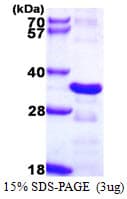 Human CHMP2B Protein (Recombinant His)