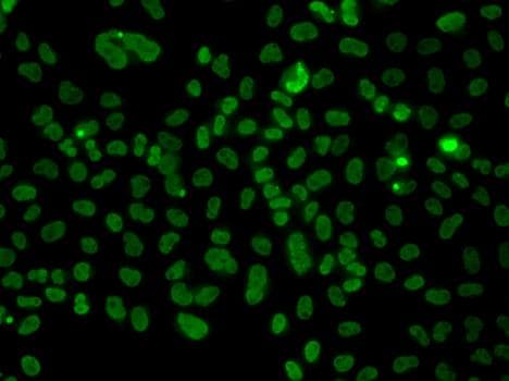 PLCXD2 Antibody