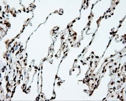 DAPK2 / DAP Kinase 2 Antibody (clone OTI1F7, Carrier-free)