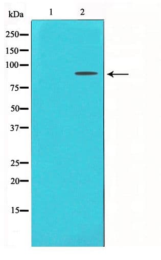 Polyclonal Rabbit anti-Human FGFR3 Antibody (IHC, WB)