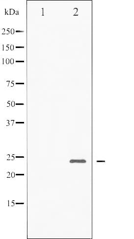 BAD Antibody (phospho-Ser136)