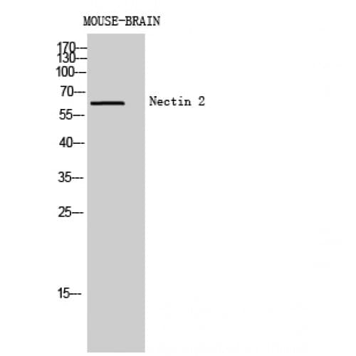 PVRL2 / CD112 Antibody (151-200 aa, Internal)