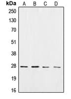 Polyclonal Rabbit anti-Human CSNK2B / Phosvitin Antibody (C-Terminus, WB)