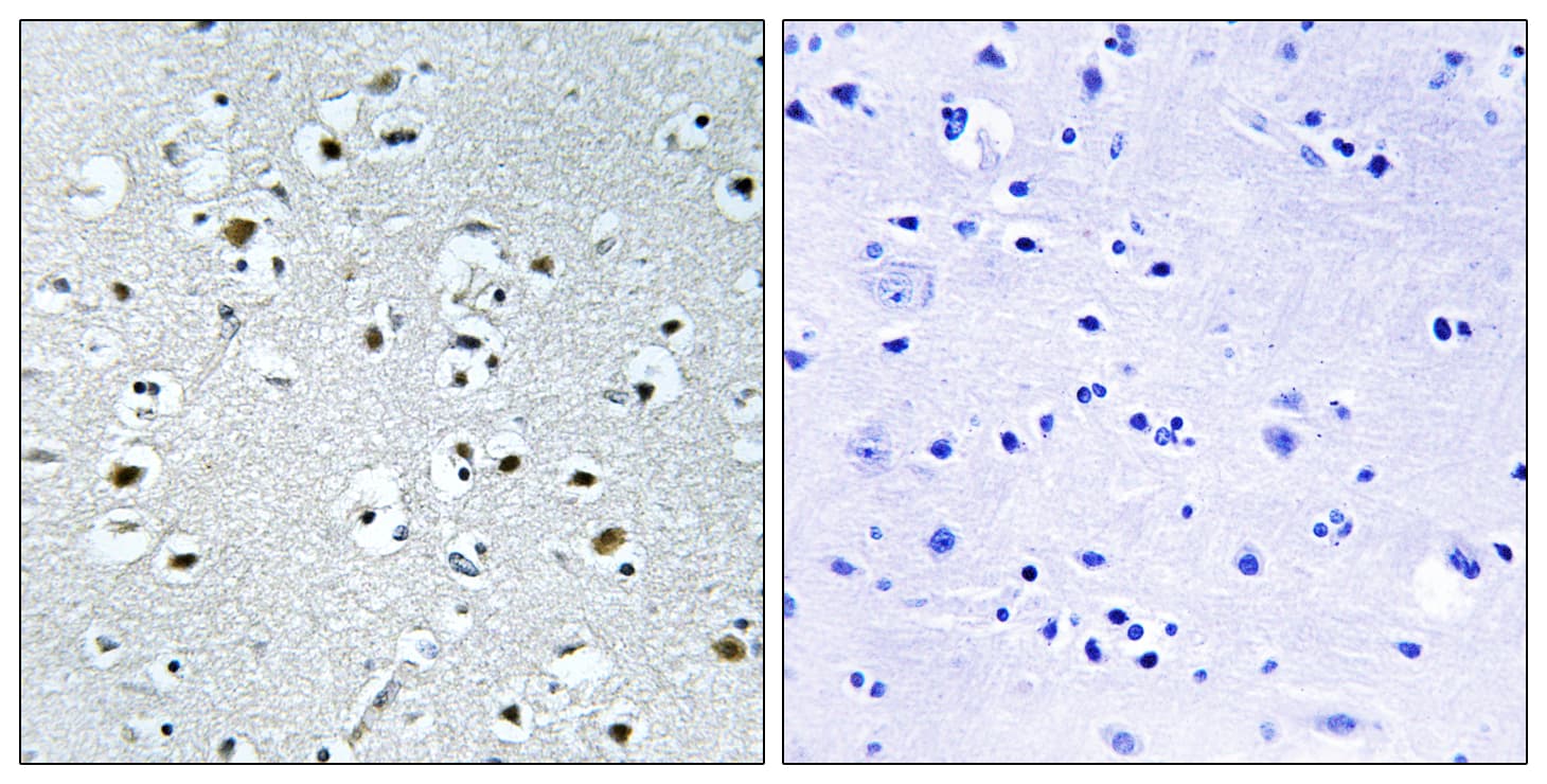 PPRC1 Antibody (aa1609-1658)