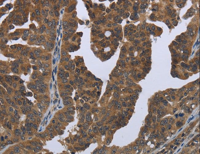 Polyclonal Rabbit anti-Human GYS2 Antibody (IHC)