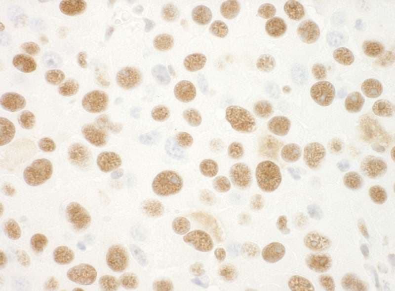 NPM1 / NPM / Nucleophosmin Antibody (aa250-294)
