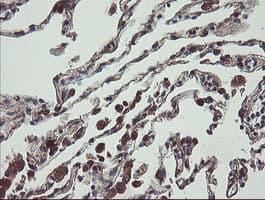 UBE2J1 Antibody (clone OTI1F6)