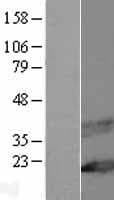 MAL Protein (Over-Expression Lysate Myc-DDK (Flag))
