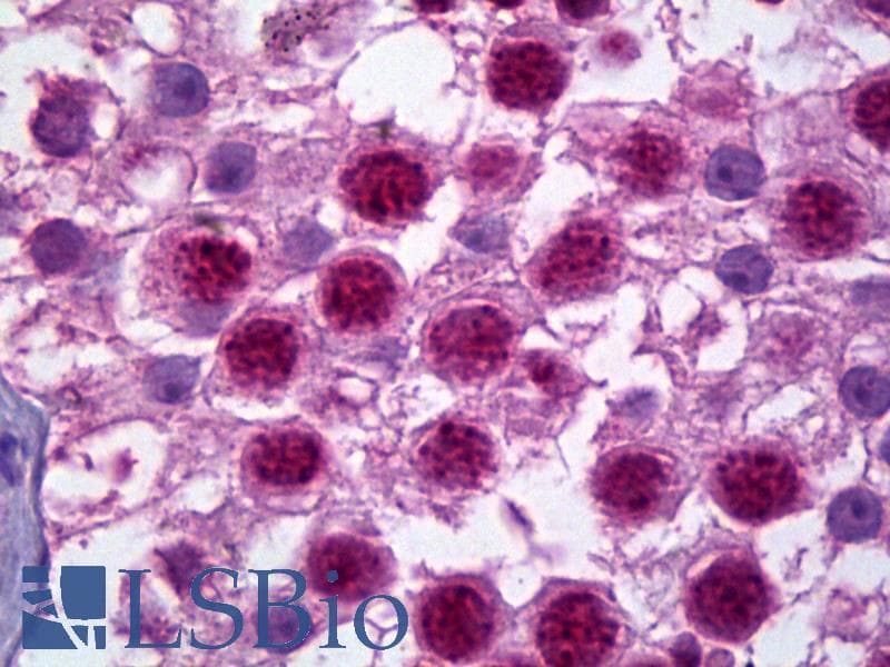 IHC-plus™ HES1 / HES-1 Antibody (N-Terminus)