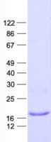 Human FUNDC1 Protein (Recombinant His, N-Terminal)