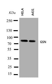 GSN / Gelsolin Antibody (aa763-775)