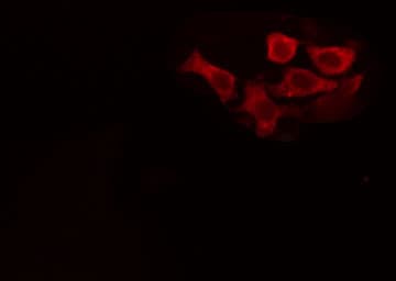 Polyclonal Rabbit anti-Human GRIA1 / GLUR1 Antibody (IHC, IF, WB)