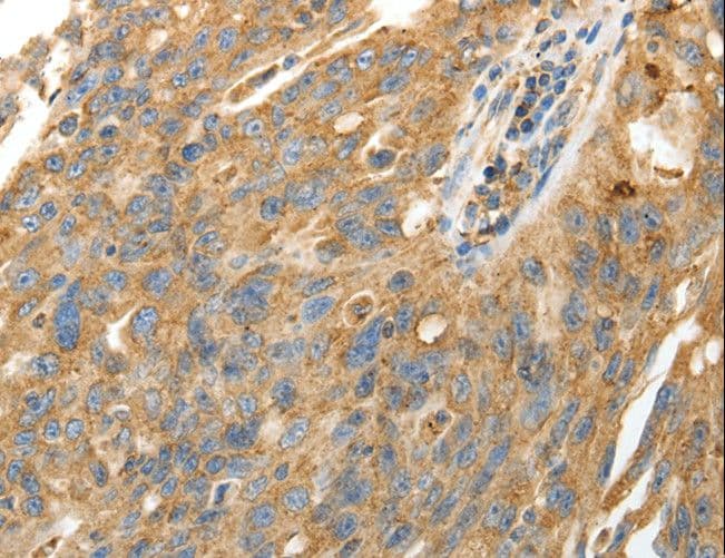 CALR / Calreticulin Antibody