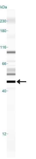 EPOR / EPO Receptor Antibody (aa300-400)