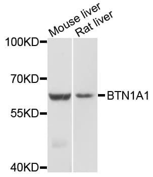 Polyclonal Rabbit anti-Human BTN1A1 Antibody (WB)