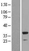 NFKBID / IkappaBNS Protein (Over-Expression Lysate Myc-DDK (Flag))