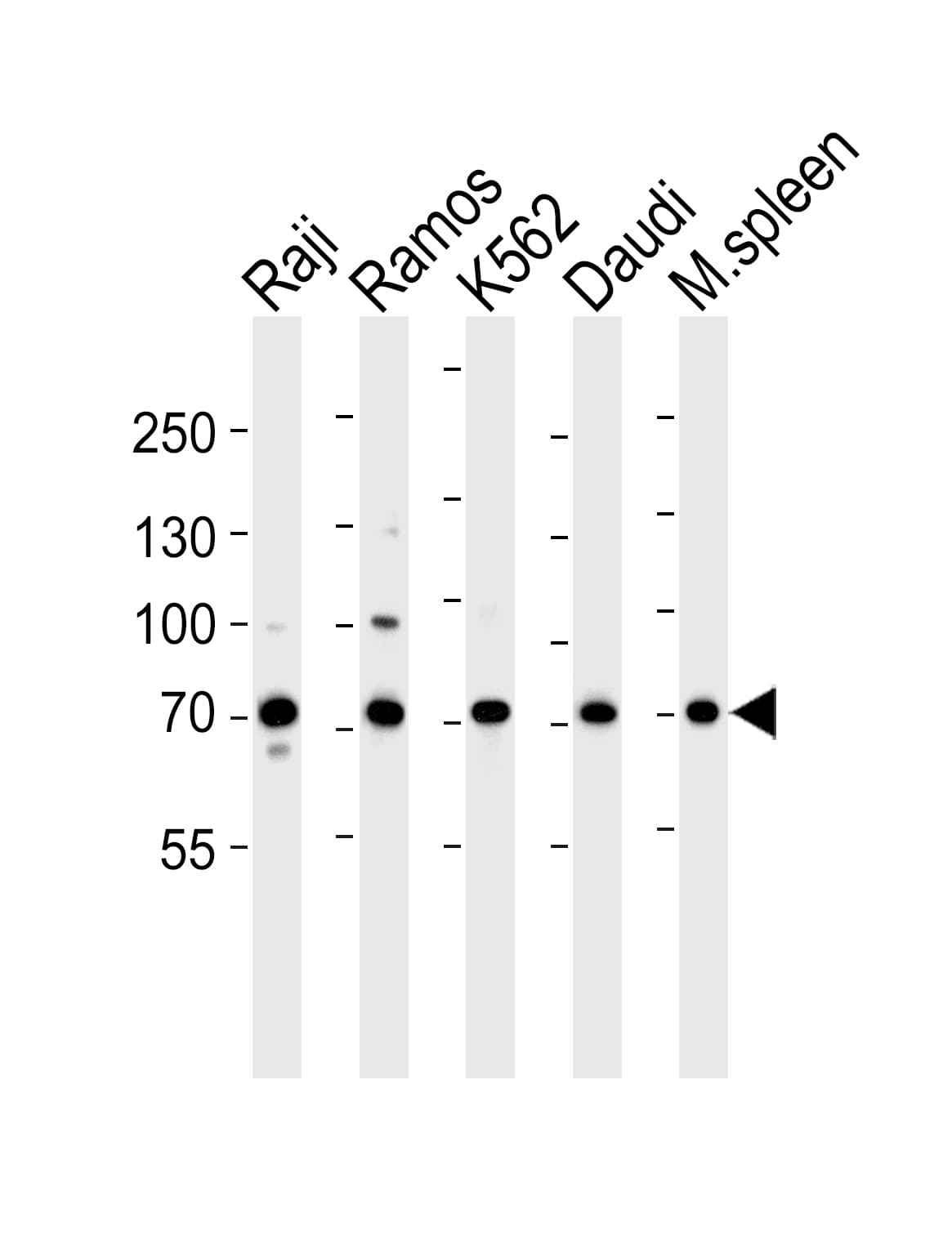 BTK Antibody (aa396-430)
