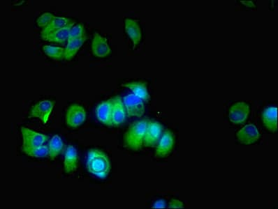 CYP17 / CYP17A1 Antibody (aa24-508)