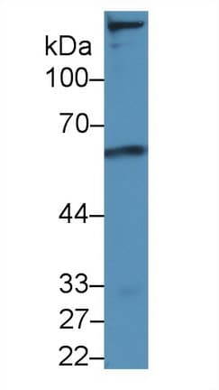LDLR / LDL Receptor Antibody (aa335-588, APC)