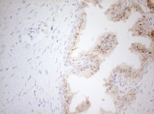 Monoclonal Mouse anti-Human CPM / Carboxypeptidase M Antibody (clone OTI2D11, aa124-423, IHC, WB)