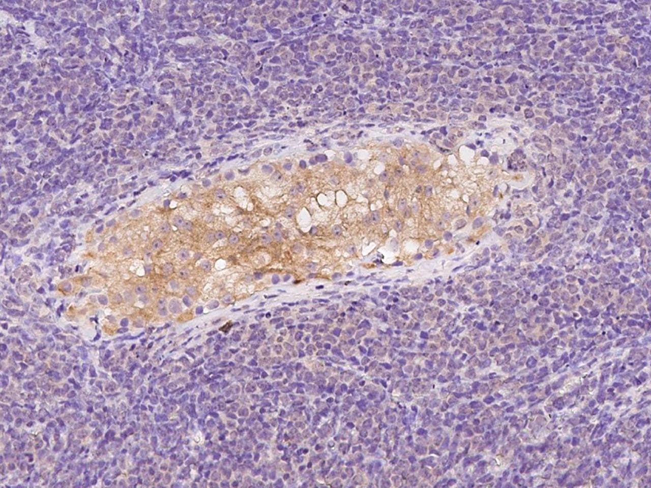 ZNF659 / ZNF385D Antibody