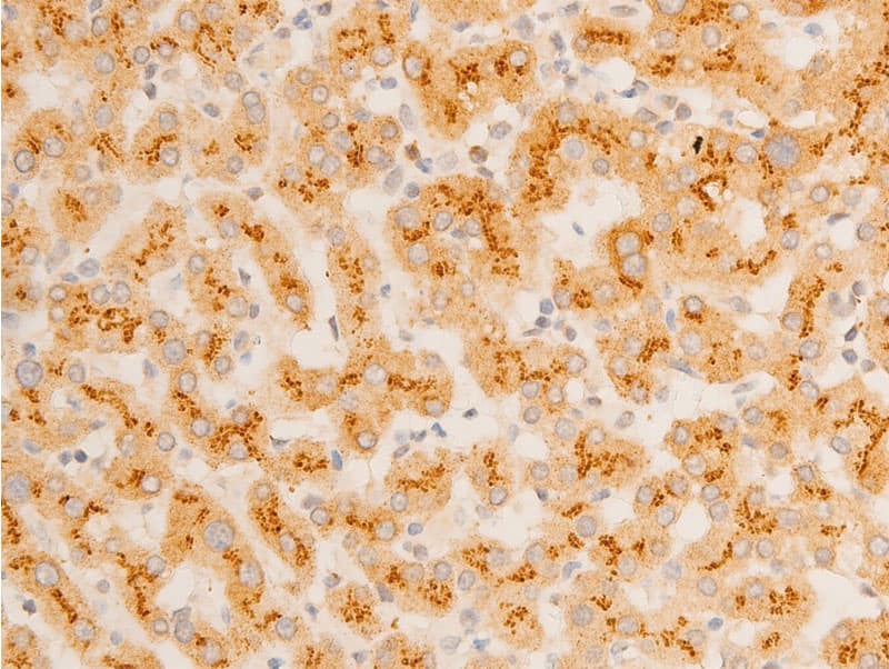 Polyclonal Rabbit anti-Human NFKBIE / IKB Epsilon Antibody (phospho-Ser22, IHC, IF, WB)