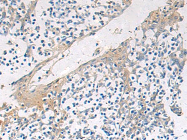 Polyclonal Rabbit anti-Human GBA / Glucosidase Beta Acid Antibody (IHC, WB)