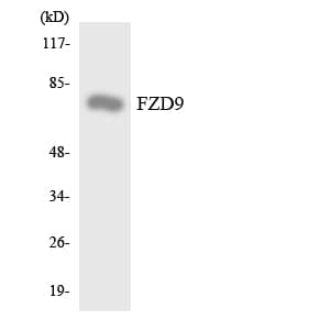 FZD9 / Frizzled 9 Antibody (aa35-84)