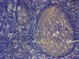 PDLIM2 / SLIM Antibody (clone OTI14D9)