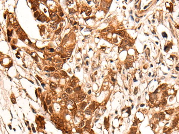 Polyclonal Rabbit anti-Human HOXD8 Antibody (IHC)