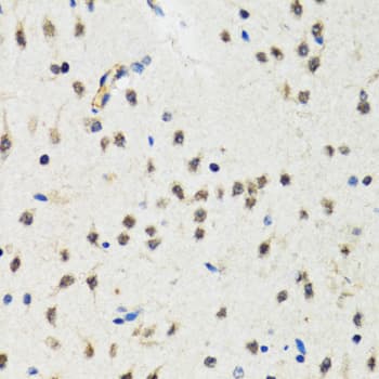 Polyclonal Rabbit anti-Human CHUK / IKKA / IKK Alpha Antibody (IHC, IF, WB)