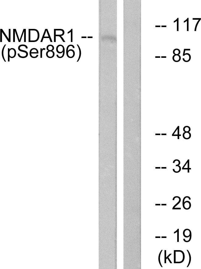 Polyclonal Rabbit anti-Human GRIN1 / NMDAR1 Antibody (phospho-Ser896, IHC, WB)