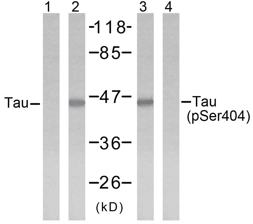Polyclonal Rabbit anti-Human MAPT / Tau Antibody (p404, WB)