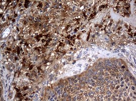 Monoclonal Mouse anti-Human NME1 / NM23 Antibody (clone OTI7F2, IHC, WB)