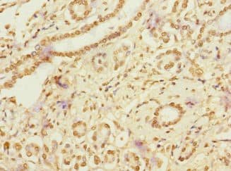 Polyclonal Rabbit anti-Human RANBP3 Antibody (IHC)