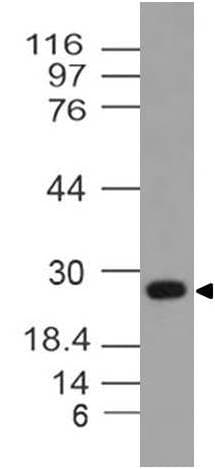 YWHAQ / 14-3-3 Theta Antibody