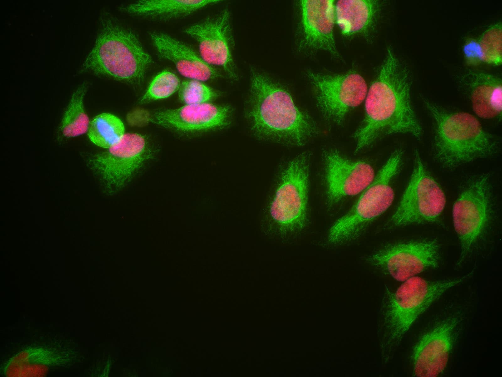 Monoclonal Mouse anti-Human HMG1 / HMGB1 Antibody (clone 1F3, IF, WB)
