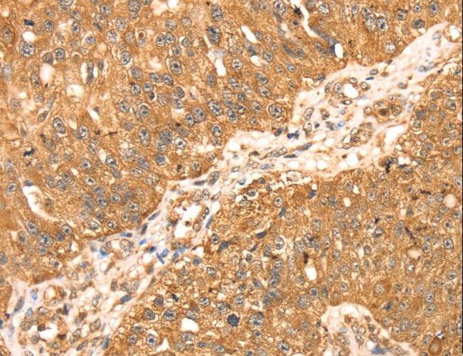Polyclonal Rabbit anti-Human MAPK7 / ERK5 Antibody (IHC, WB)