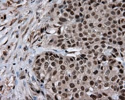 LTA4H / LTA4 Antibody (clone OTI7D11)