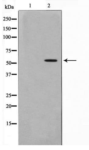 TRIM38 Antibody
