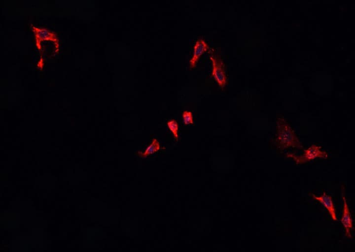 IKBKG / NEMO / IKK Gamma Antibody