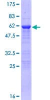 Human ZNF397 Protein (Recombinant GST)