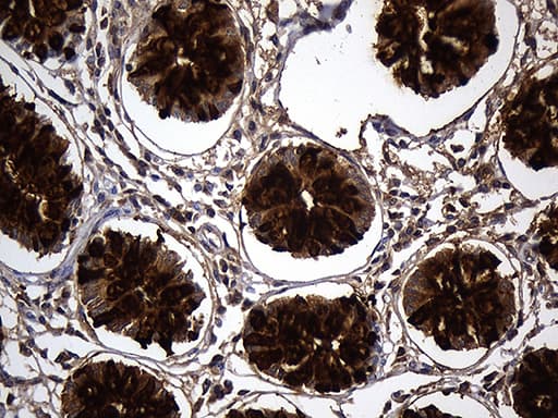 TFF3 / Trefoil Factor 3 Antibody (aa72-130, clone OTI5B2)