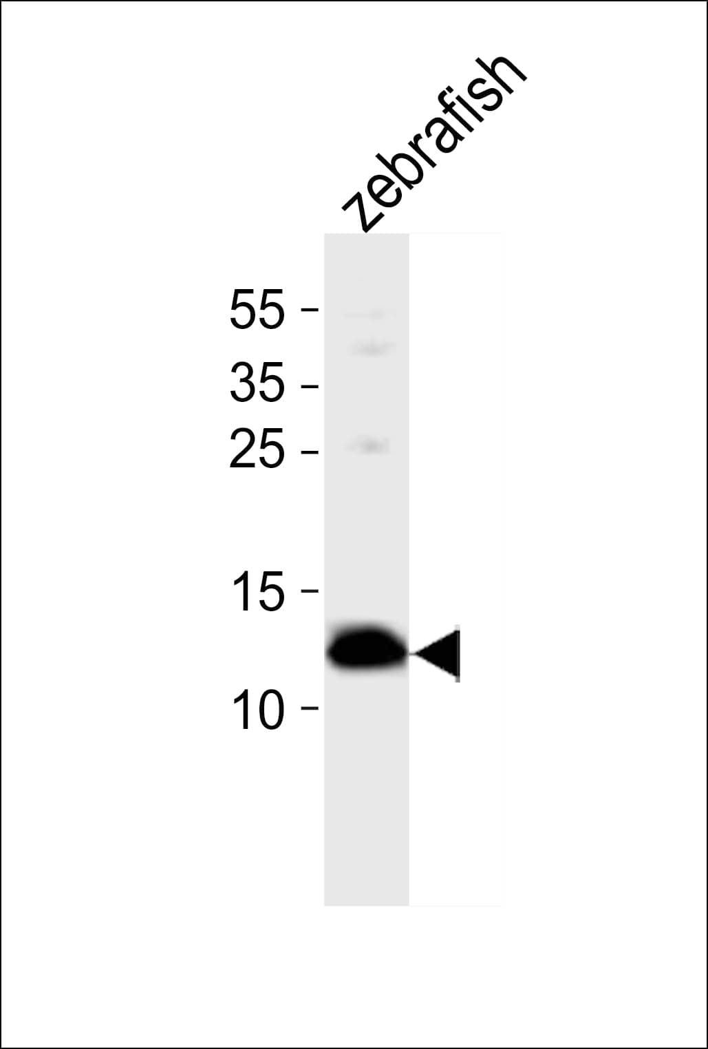 ba1 Antibody (aa2-35)
