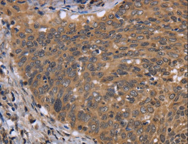 FGFR1OP / FOP Antibody
