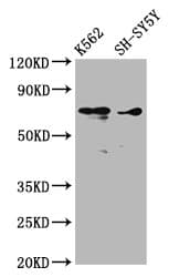 Polyclonal Rabbit anti-Human ALOX12 / 12 Lipoxygenase Antibody (IHC, IF, WB)