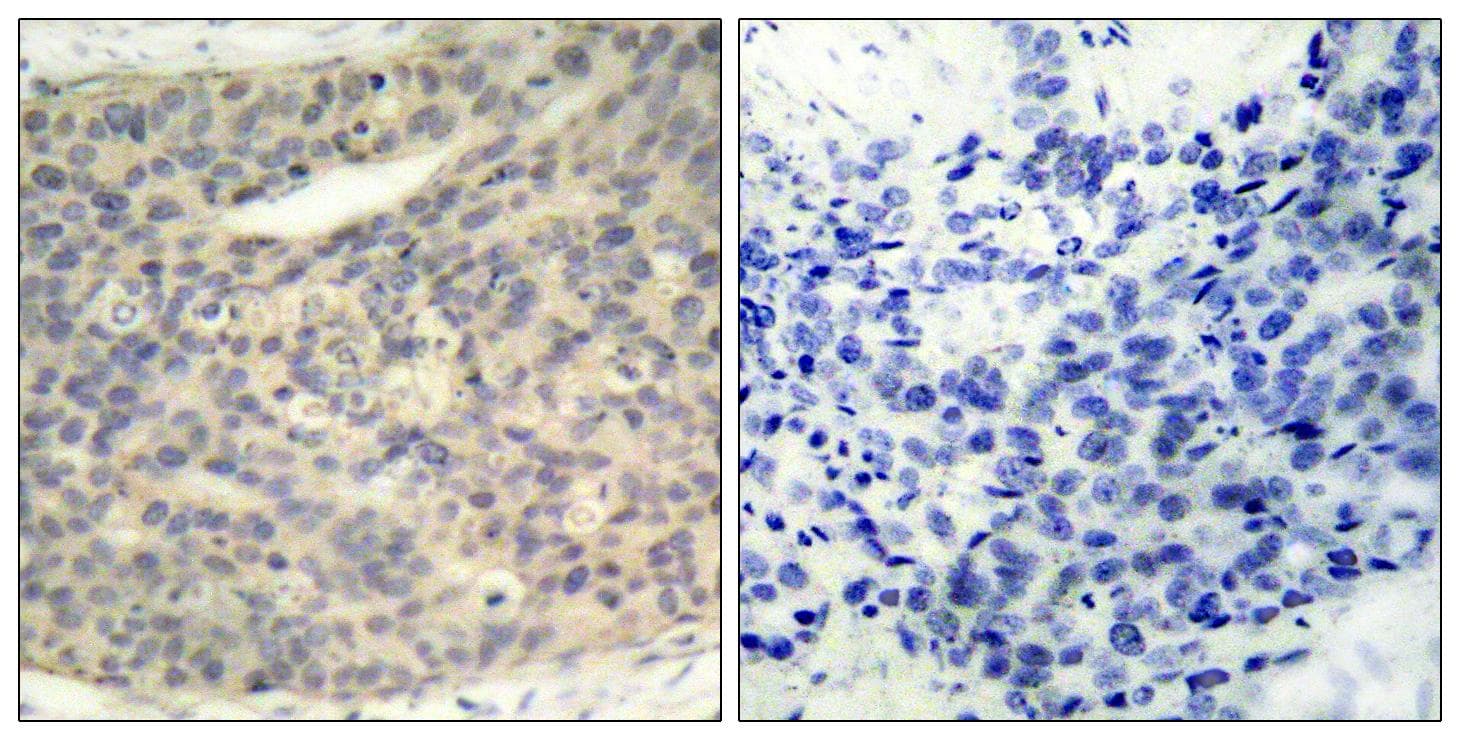 LIMK1 / LIMK Antibody (phospho-Thr508)