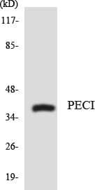 ECI2 / PECI Antibody (aa56-105)