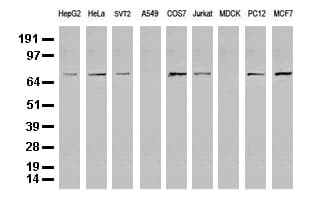 FOXP1 Antibody (clone UMAB89)