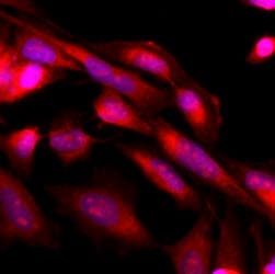 Monoclonal Mouse anti-Human MAPK3 / ERK1 Antibody (clone AT1A2, IF, WB)